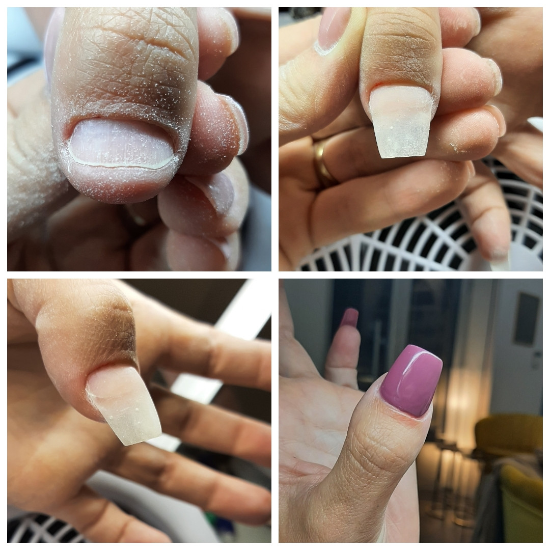 Rekonstrukcija nokta - La Vie beauty centar, Sarajevo Lakiranje noktiju Nokti Lakiranje noktiju, Sarajevo, Centar - Stari Grad