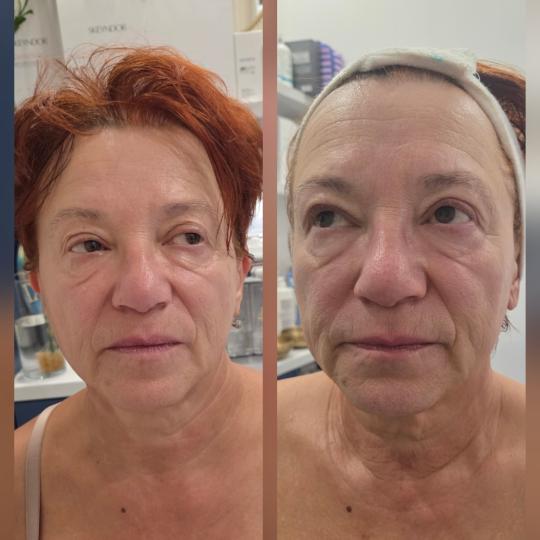 Angels Beauty - Banja Luka usluga
