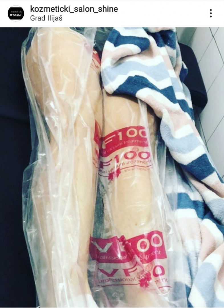 Shine - deaktivirano #sarajevo Tretmani za mršavljenje