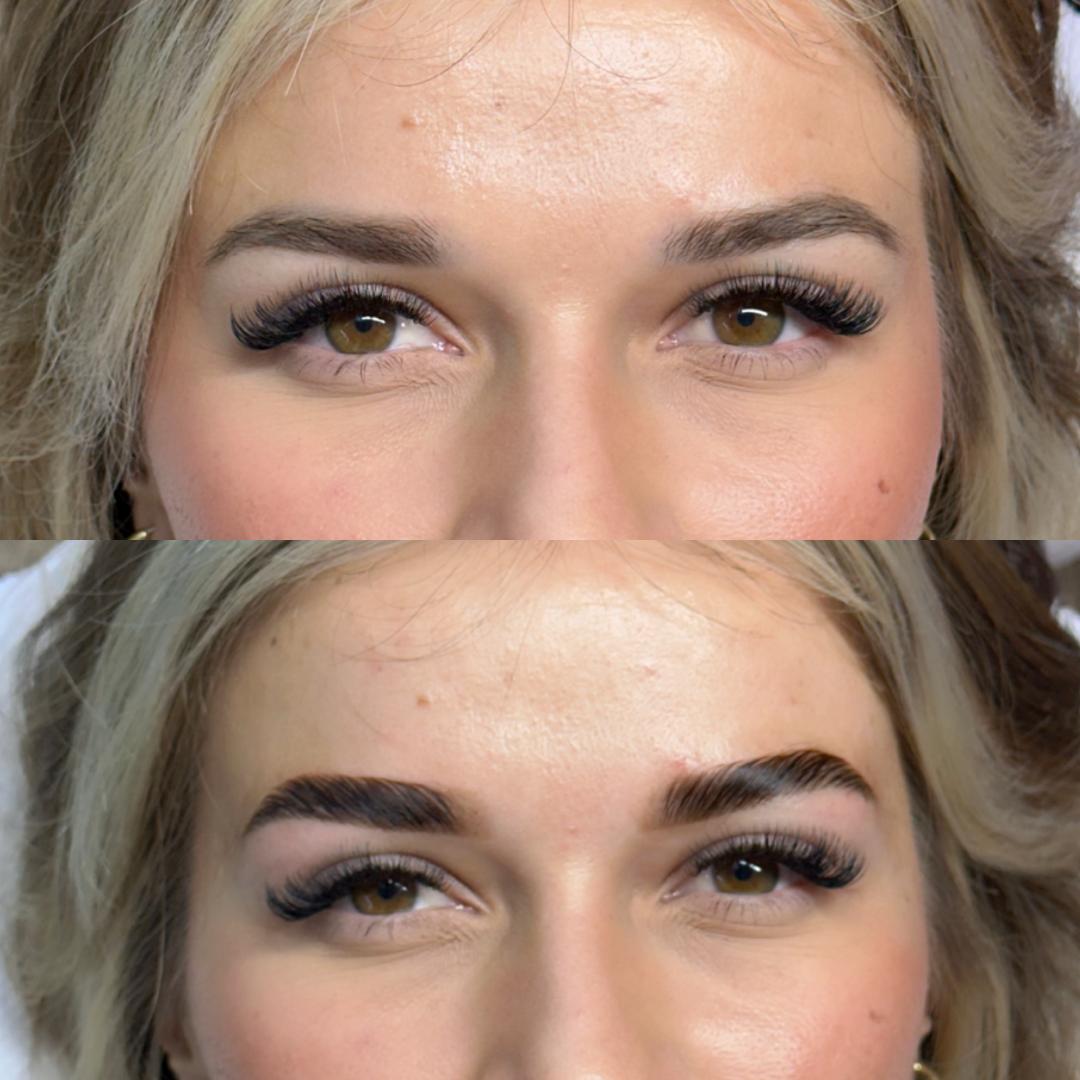 Uljepšaj se #sarajevo Obrve Brow lift