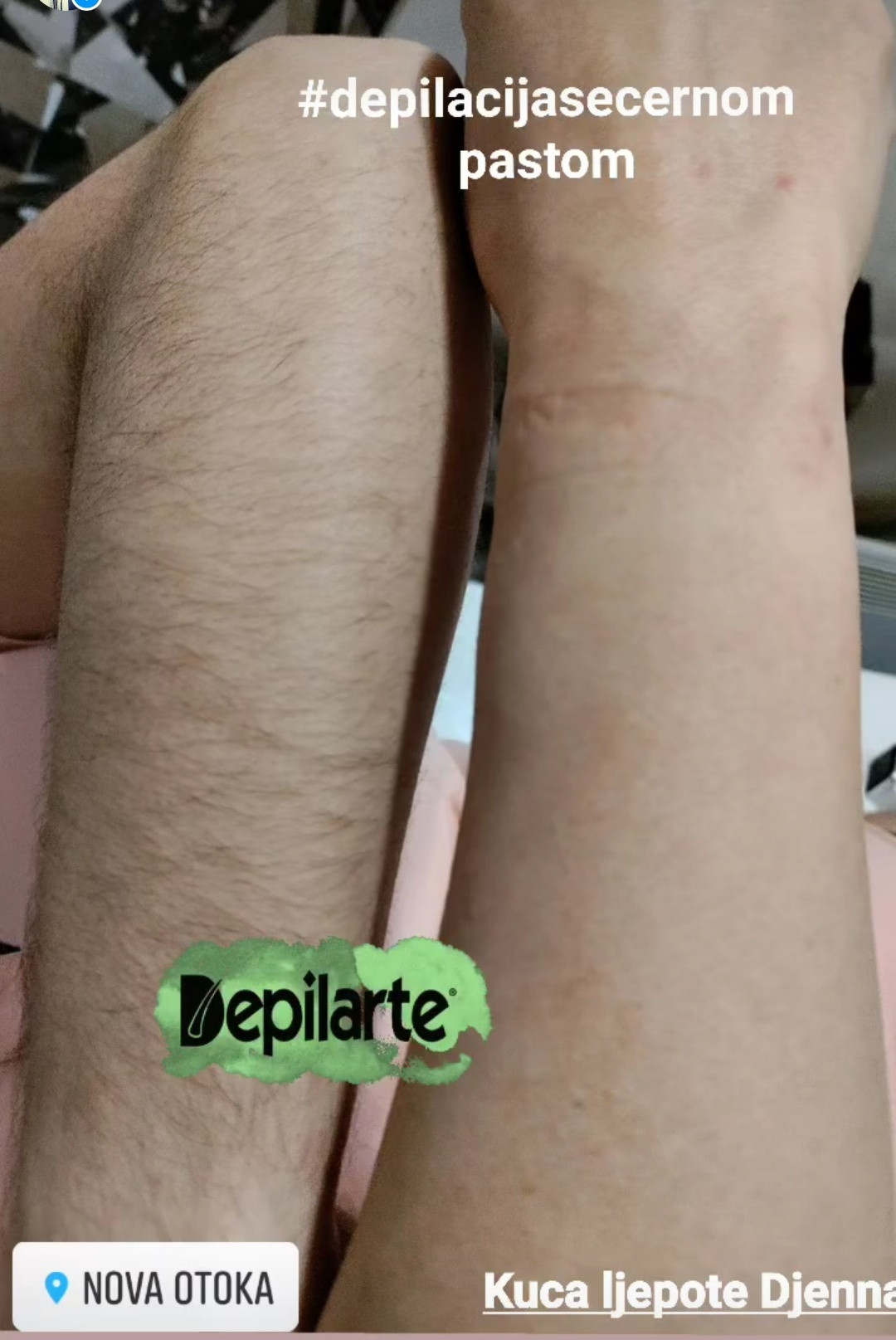 Kuća ljepote Djenna #sarajevo Depilacija šećernom pastom Depilacija ruku šećernom pastom