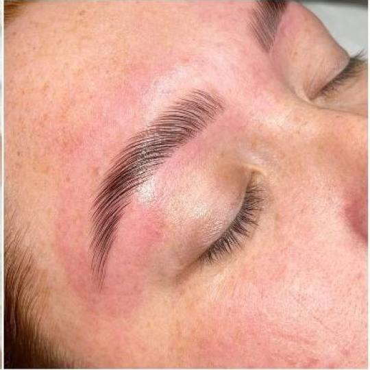 Signature #tuzla Obrve Edukacija - brow lift