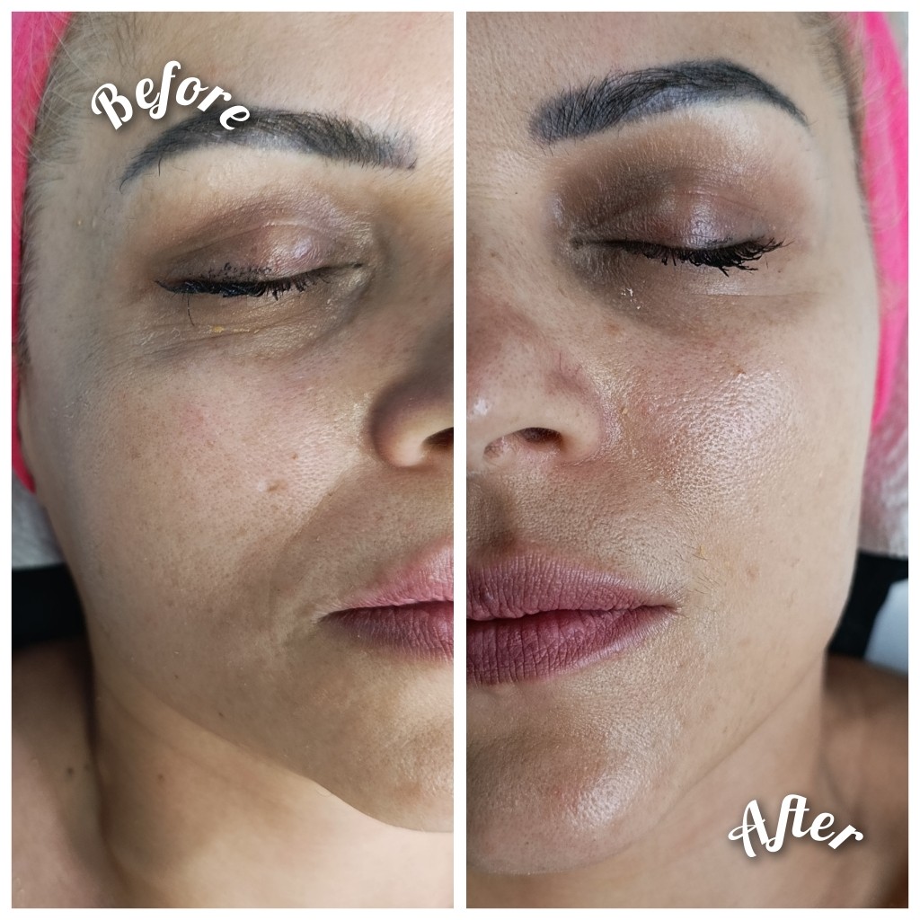 Soovica by Lida #tuzla