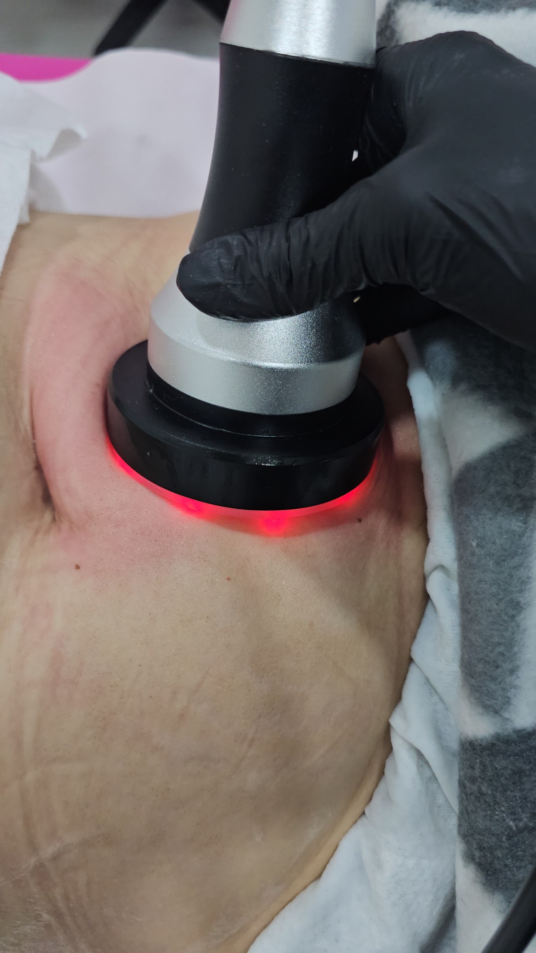 Sandra #visoko Tretmani tijela Kavitacija - stomak