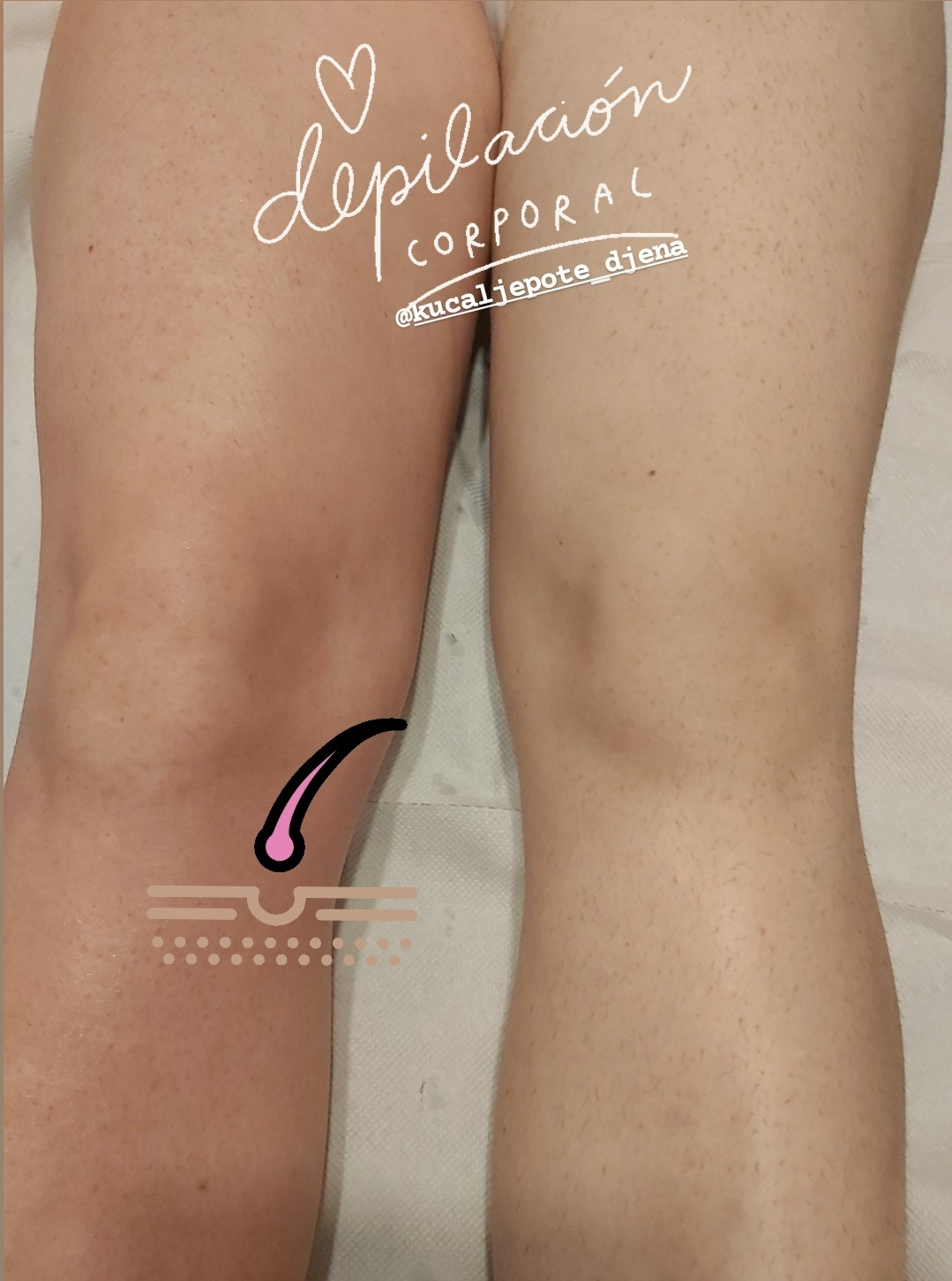 Kuća ljepote Djenna #sarajevo Depilacija šećernom pastom Depilacija nogu šećernom pastom