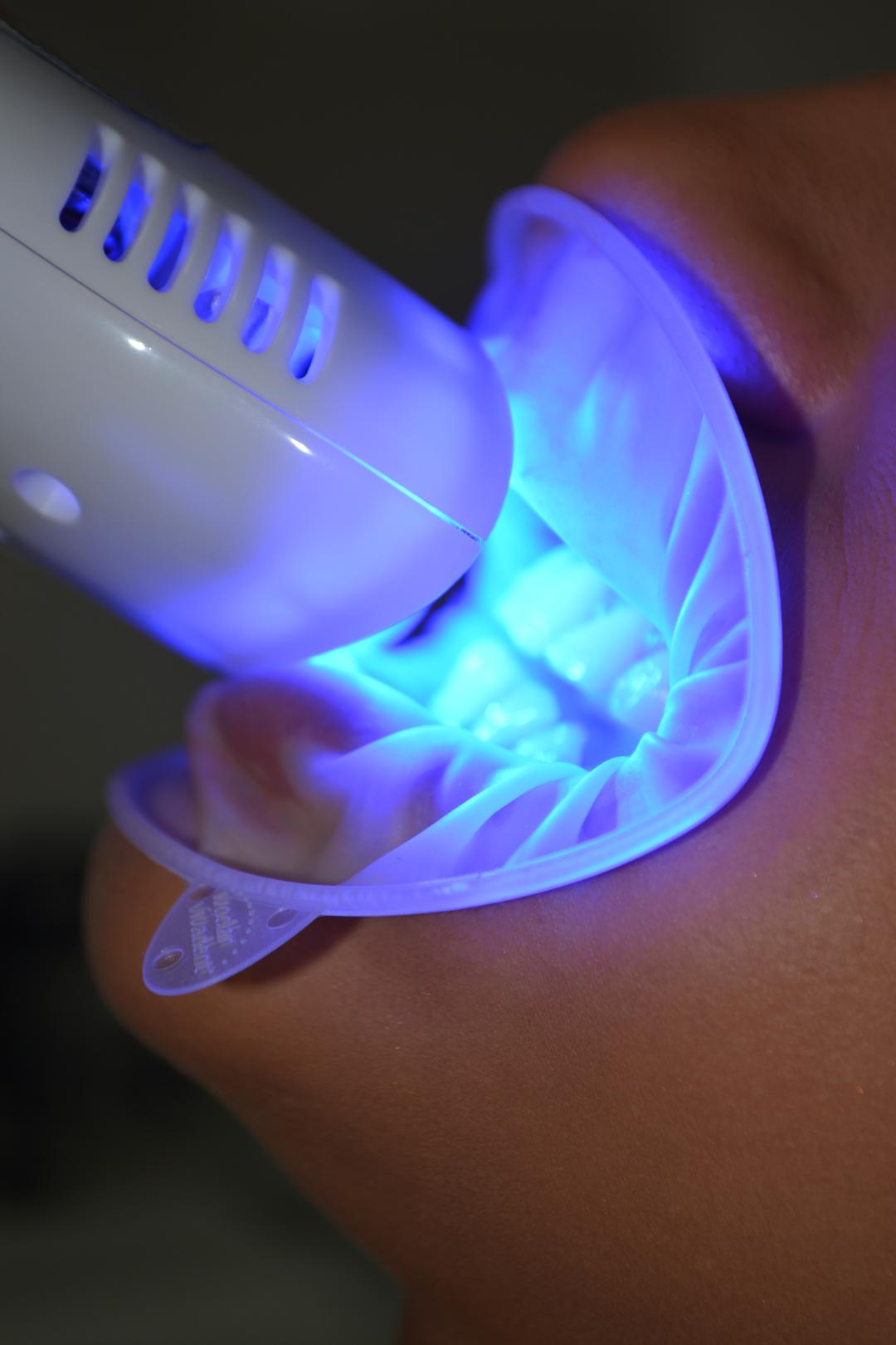 La Piel #mostar Tretmani tijela Lasersko izbjeljivanje zuba - 3 sesije