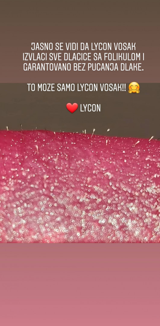 Relax Studio Hodžić #sarajevo Depilacija voskom Depilacija cijelog lica Lycon voskom - za dame i muškarce