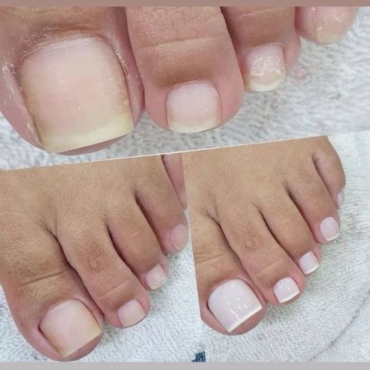 Poezija ljepote #sarajevo Estetski pedikir Ruska pedikura + lakiranje noktiju