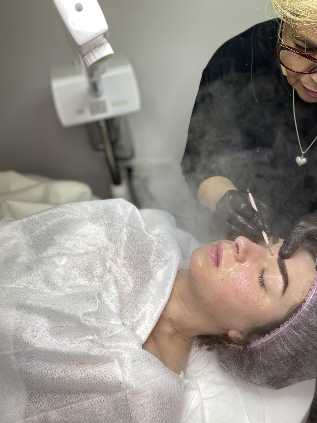 Senka #sarajevo Tretman lica Ciscenje lica sa ultrazvucnom spatulom