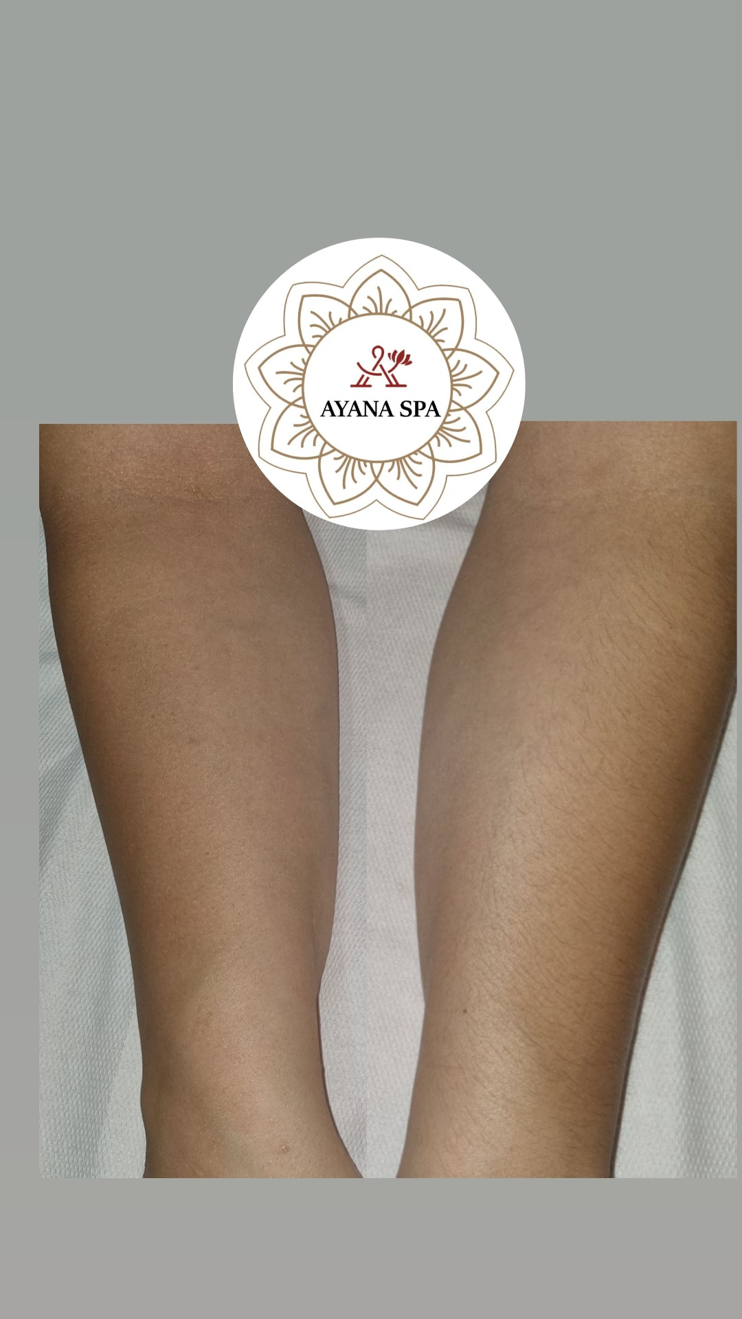 Ayana Spa #sarajevo Depilacija šećernom pastom Depilacija cijelih ruku šećernom pastom - za dame