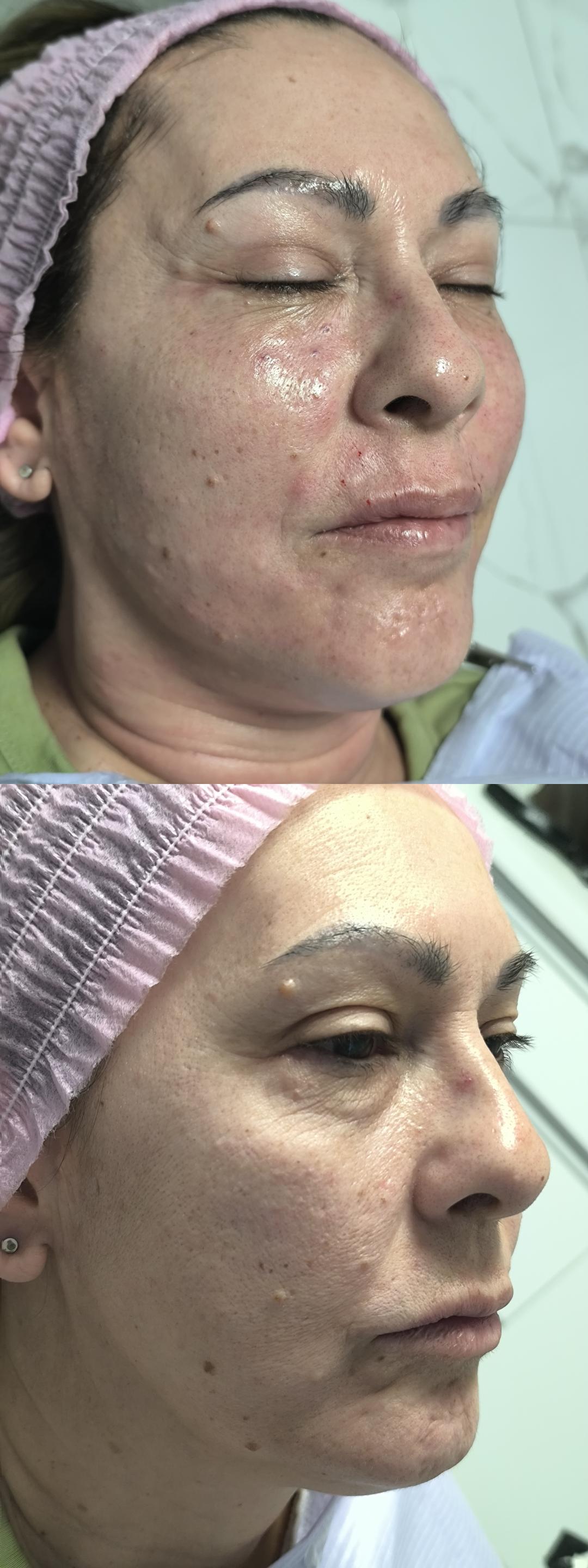 Španski sjaj - Estetika Janković, Banja Luka Tretman lica Lice Tretman lica, Banja Luka, Centar