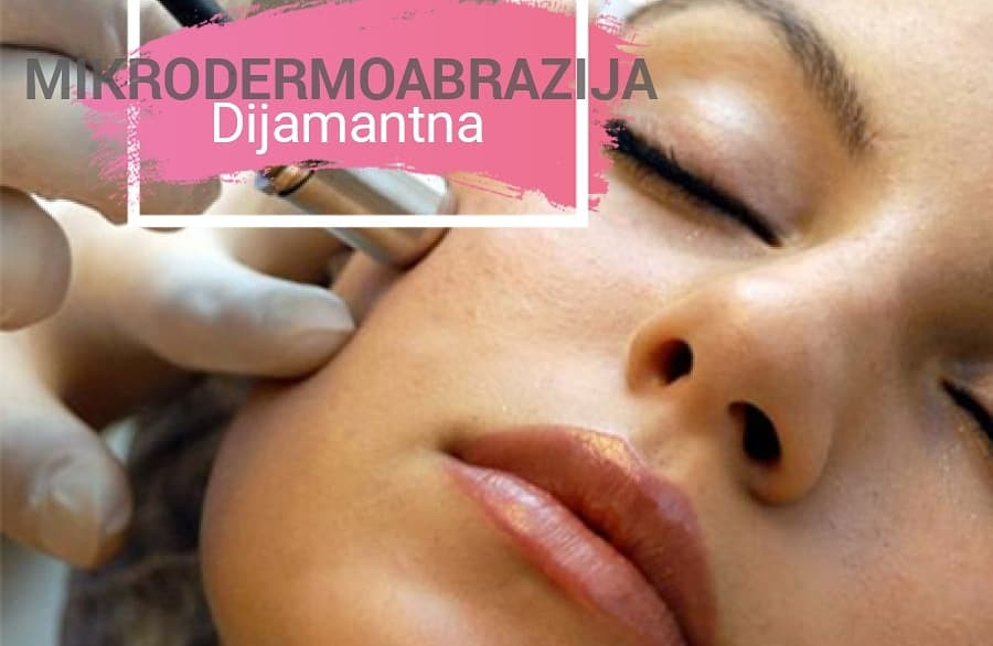 Zlatna Ruka #sarajevo Mikrodermoabrazija