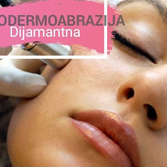 Zlatna Ruka #sarajevo Mikrodermoabrazija Mikrodermoabrazija