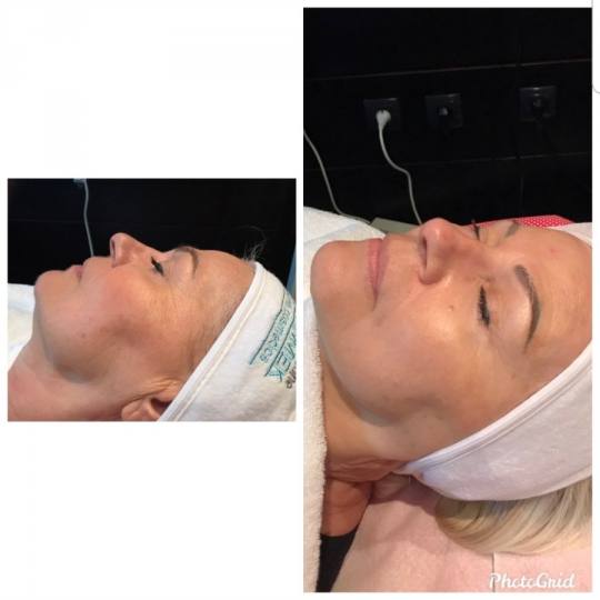 Vedrana #sarajevo Tretman lica Prije više od 60 godina, Christine Schrammek postavila je temelje or