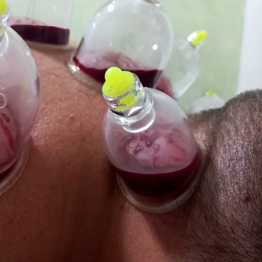 Magic #sarajevo Tretmani tijela Hidžama - leđa