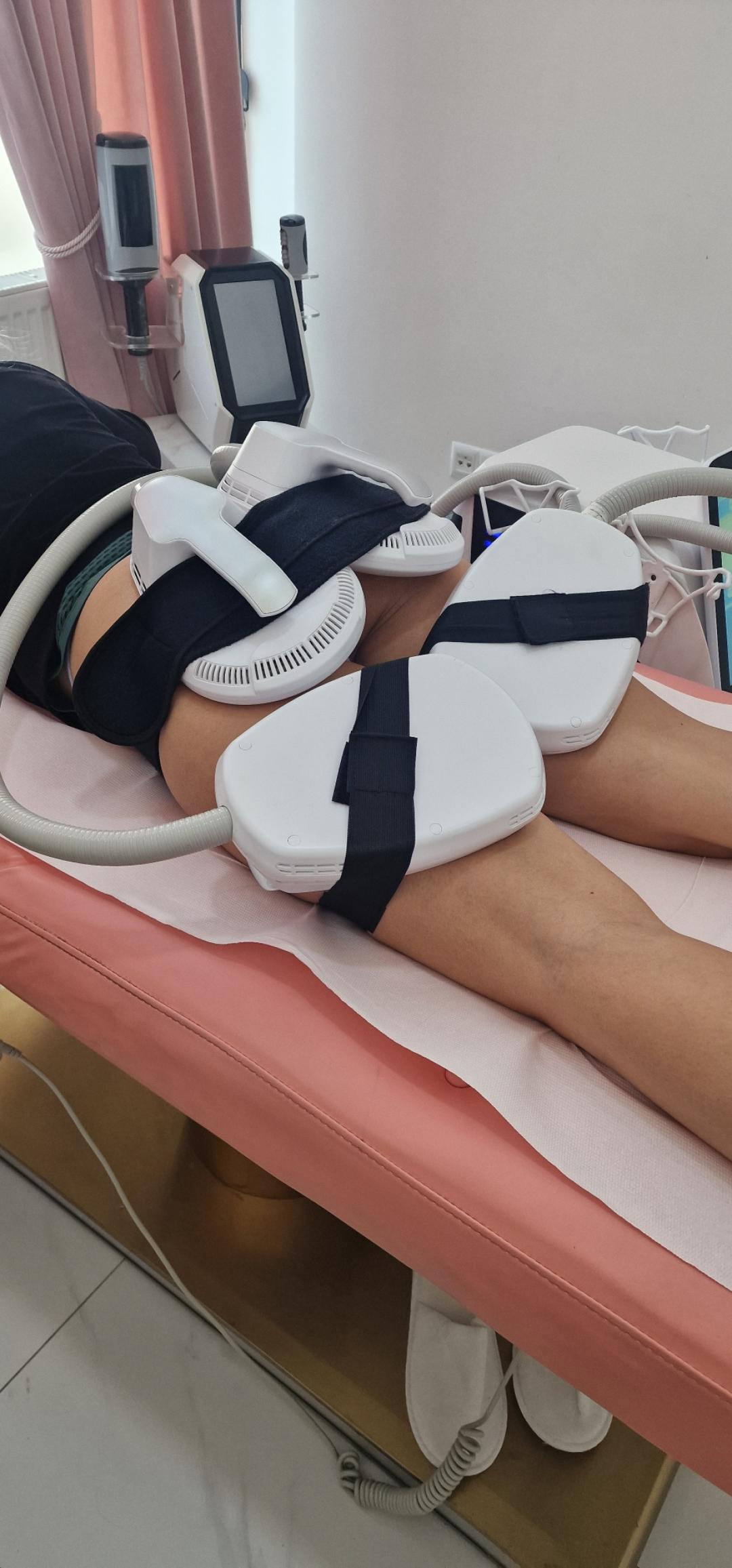 Signature #tuzla EMS trening EMS Sculpt - 4 sonde - paket od 8 tretmana