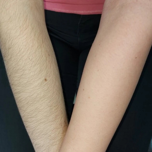 Poezija ljepote #sarajevo Depilacija voskom Depilacija citavog tijela hladnim i toplim voskom - za dame