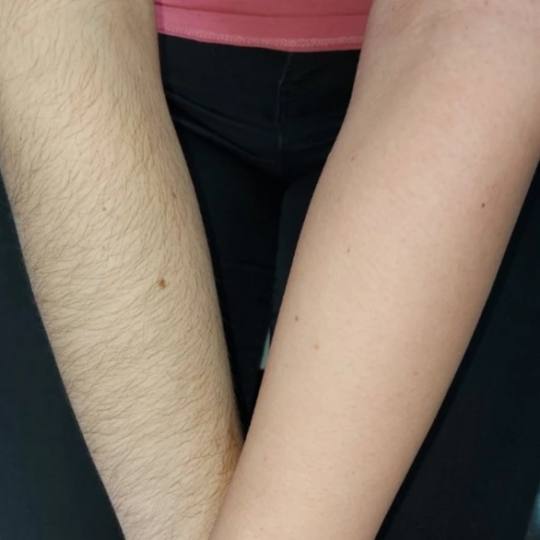 Poezija ljepote #sarajevo Depilacija voskom Depilacija citavog tijela hladnim i toplim voskom - za d