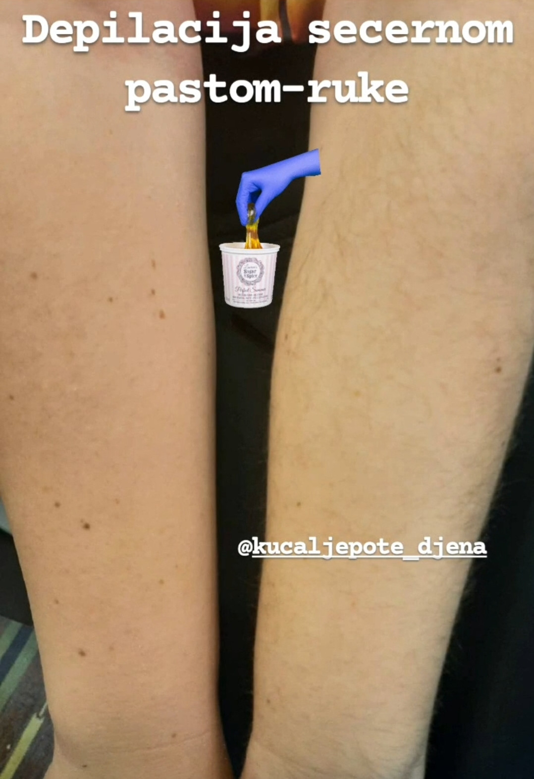 Kuća ljepote Djenna #sarajevo Depilacija šećernom pastom Depilacija ruku šećernom pastom