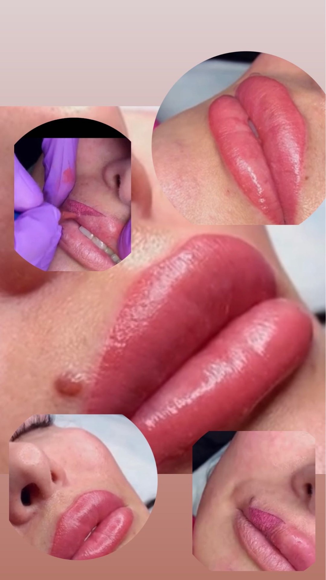 Poezija ljepote #sarajevo Trajna šminka Trajna šminka - usne