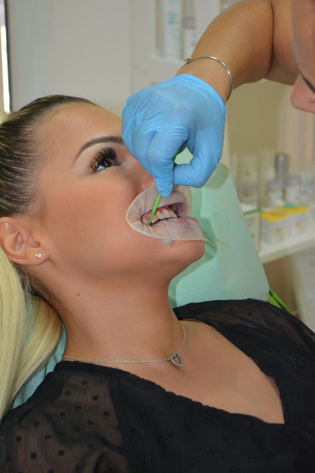 La Piel #mostar Tretmani tijela Lasersko izbjeljivanje zuba - 3 sesije