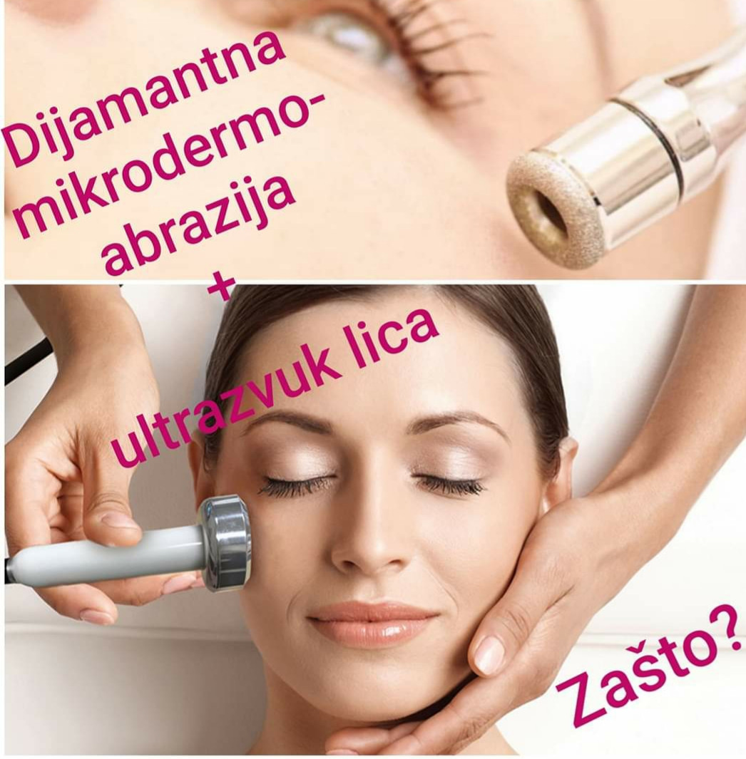 Sandra #visoko Tretman lica Hidrodermoabrazija