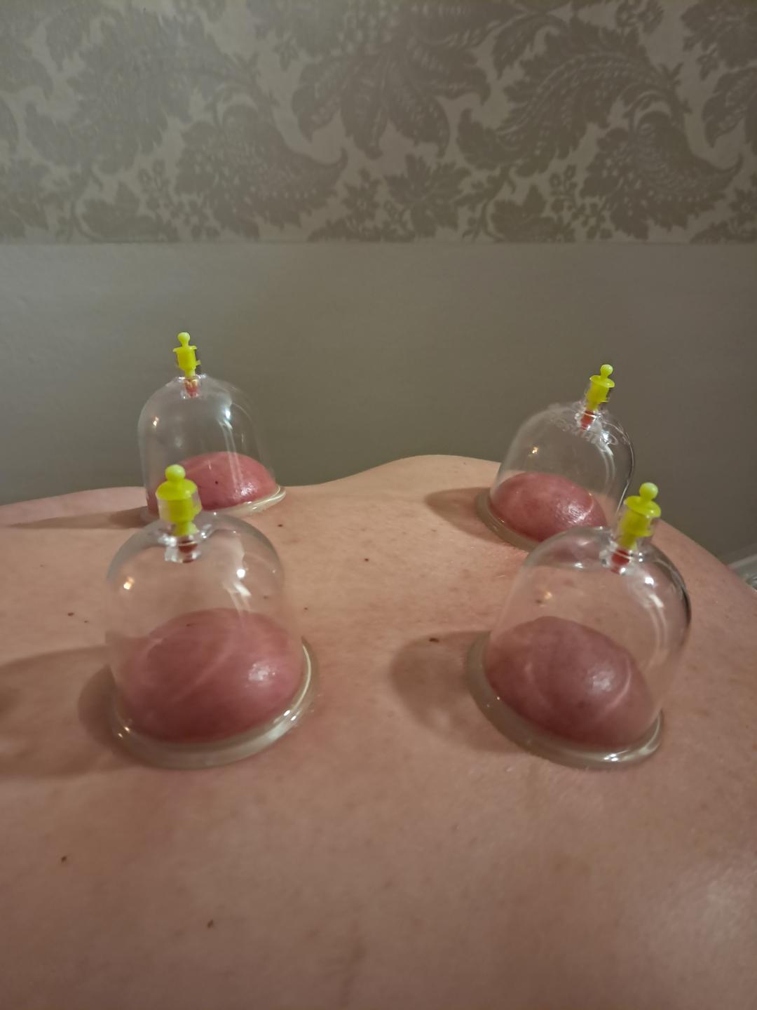 Sakina #sarajevo Masaža za opuštanje / relax / antistres Antistres paket - relax masaža 45 minuta + suho kupiranje