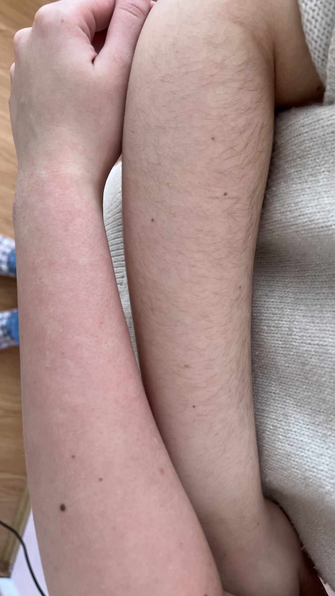 La Crème Beauty Studio #sarajevo Depilacija voskom Depilacija pola ruku hladnim voskom - za dame