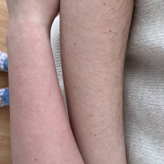 La Crème Beauty Studio #sarajevo Depilacija voskom Depilacija pola ruku hladnim voskom - za dame