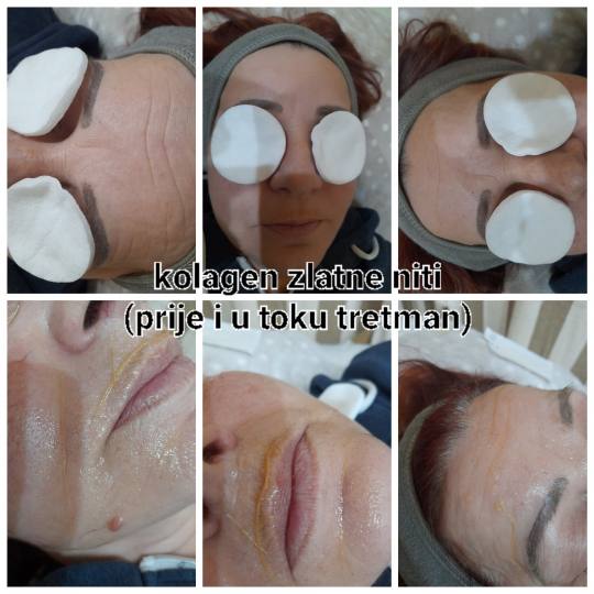 Poezija ljepote #sarajevo Ojačavanje noktiju Tretman zlatnim + srebrnim nitima lice