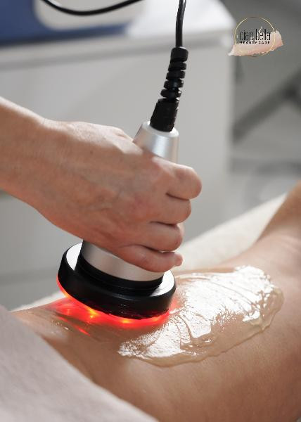 Ciao Bella Beauty Care #sarajevo Anticelulit