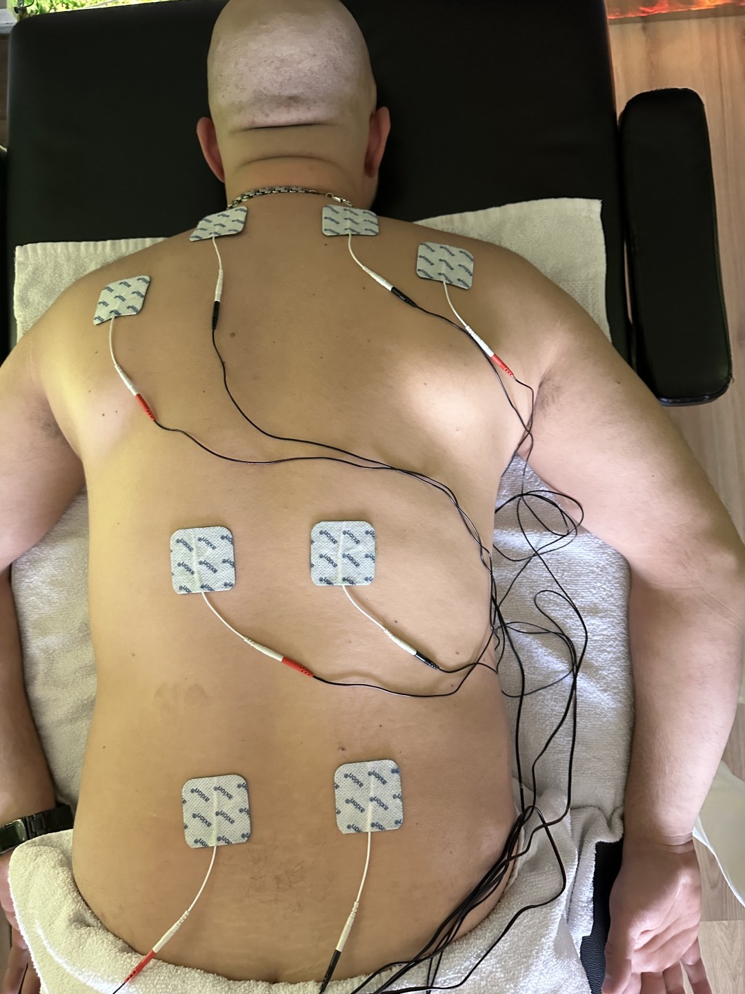 Elektrostimulacija mišića - Black Diamond - Ilidža, Sarajevo Radiotalasni i ultrazvučni tretmani Tijelo Radiotalasni i ultrazvučni tretmani, Sarajevo, Ilidža