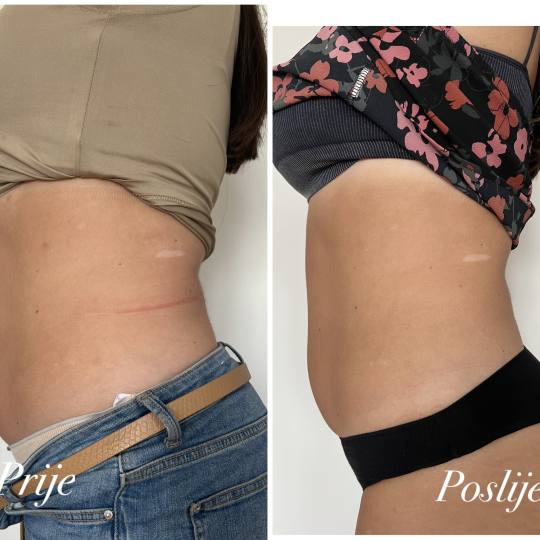 Beauty centar Eden usluga