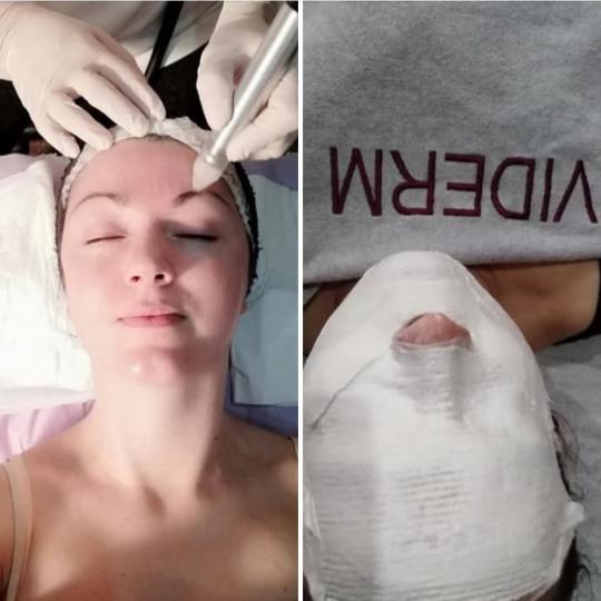 Delta M #brcko Global-antiage-benefit za tvoju kožu globalno deluje na sve vidljive znakove starost