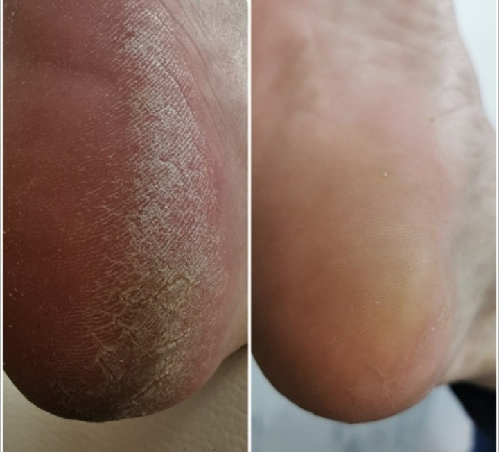 Poezija ljepote #sarajevo Estetski pedikir Ruska pedikura - bez laka