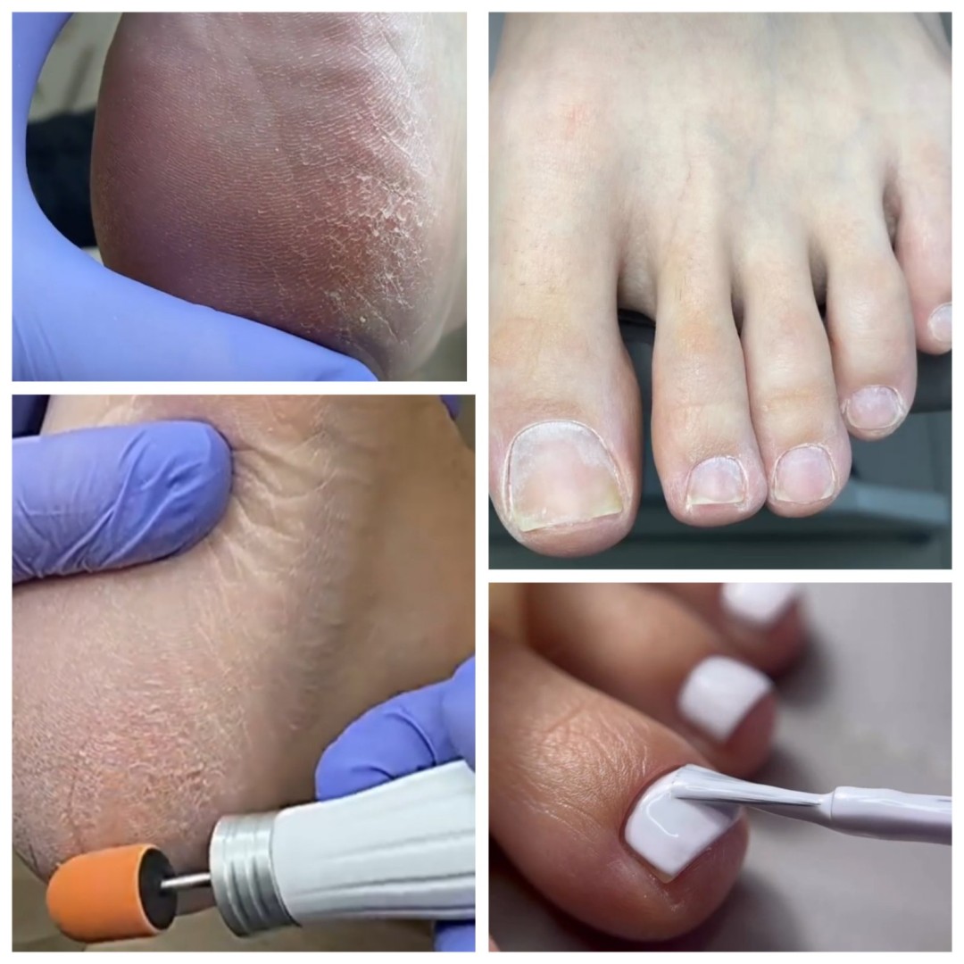 Poezija ljepote #sarajevo Estetski pedikir Klasična pedikura + trajni lak