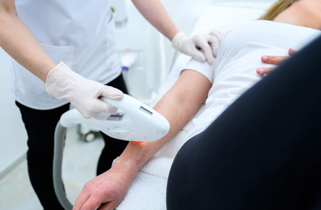 Elis Esthetic Studio #sarajevo Laserska epilacija