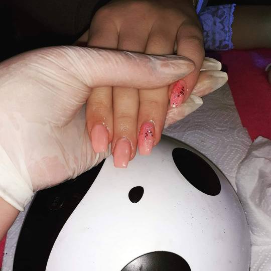 Shine - deaktivirano #sarajevo Izlivanje noktiju