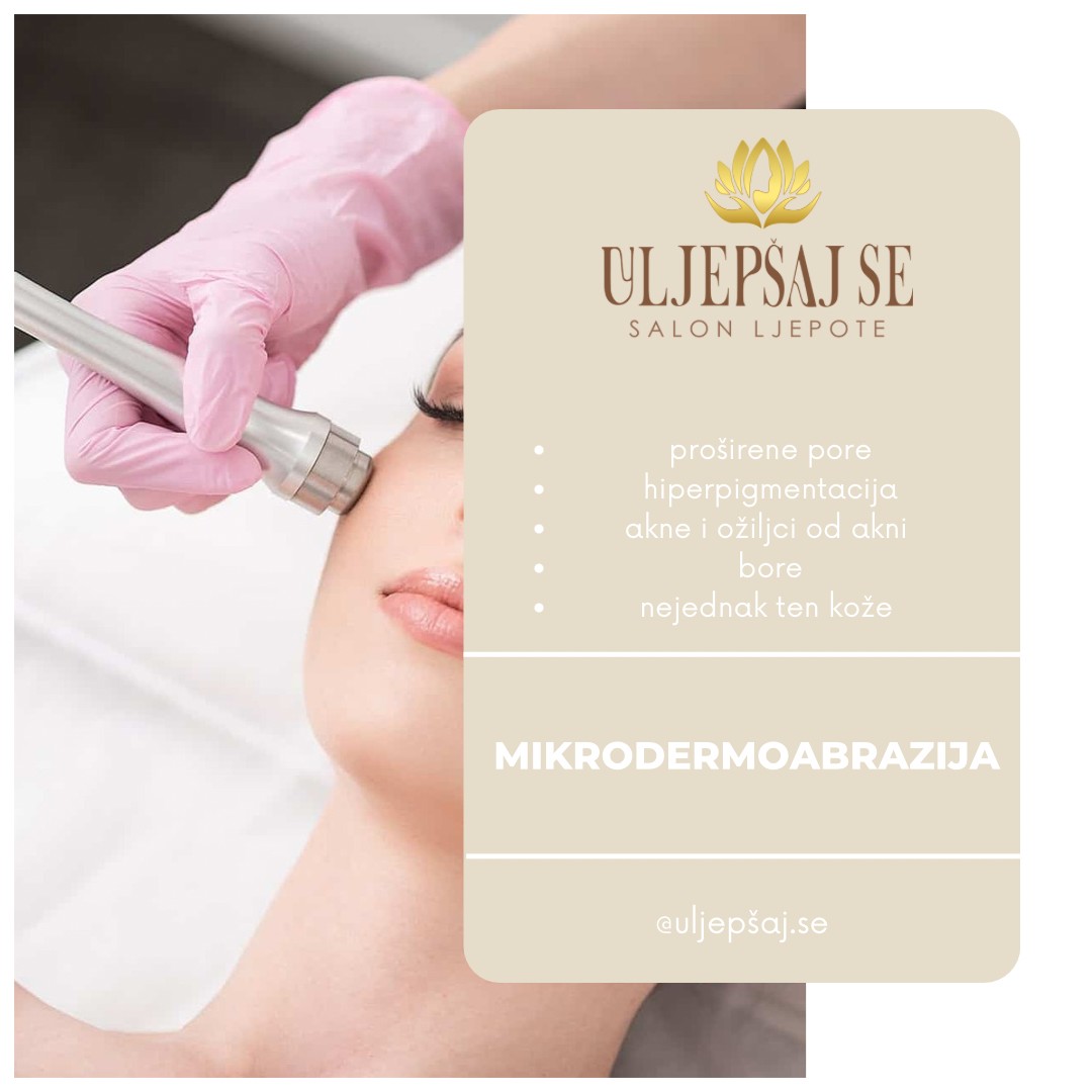 Uljepšaj se #sarajevo Tretman lica Mikrodermoabrazija