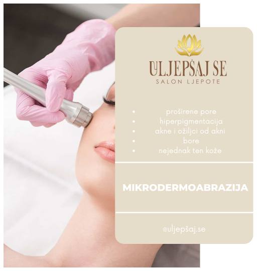 Uljepšaj se #sarajevo Tretman lica Mikrodermoabrazija