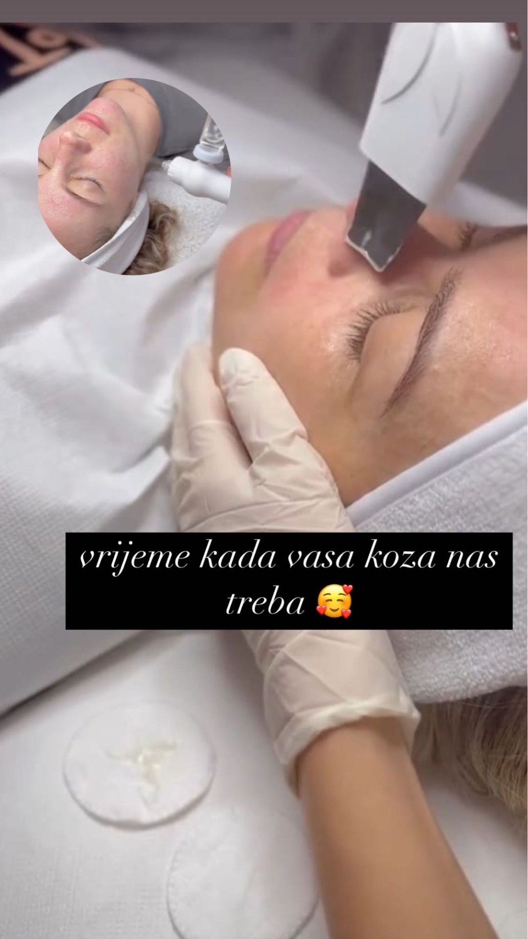 Poezija ljepote #sarajevo Piling lica Piling lica + masaža lica + maska