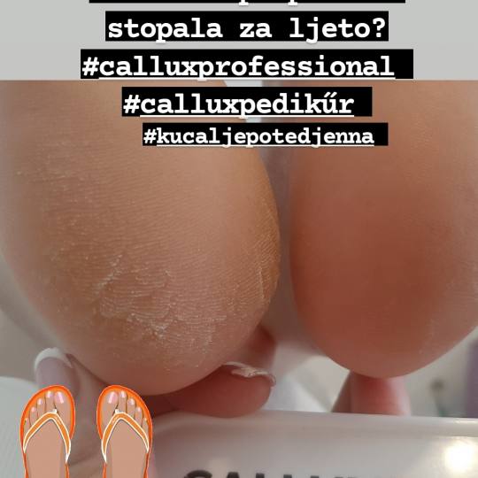 Kuća ljepote Djenna #sarajevo Estetski pedikir Callux pedikir