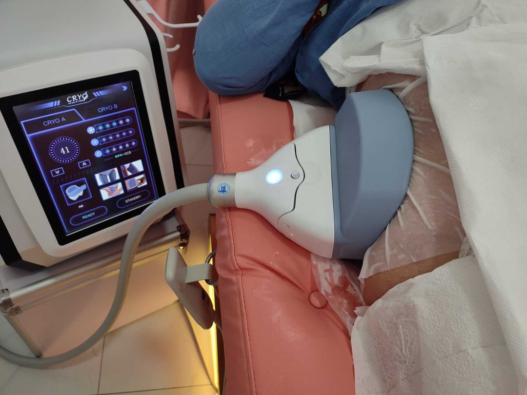 Signature #tuzla Tretmani tijela Kriolipoliza - 1 regija sa 2 sonde