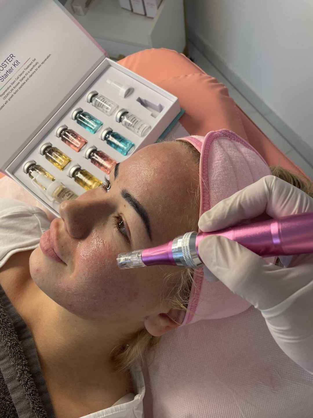 Signature #tuzla Tretman lica Microneedling tretman lica