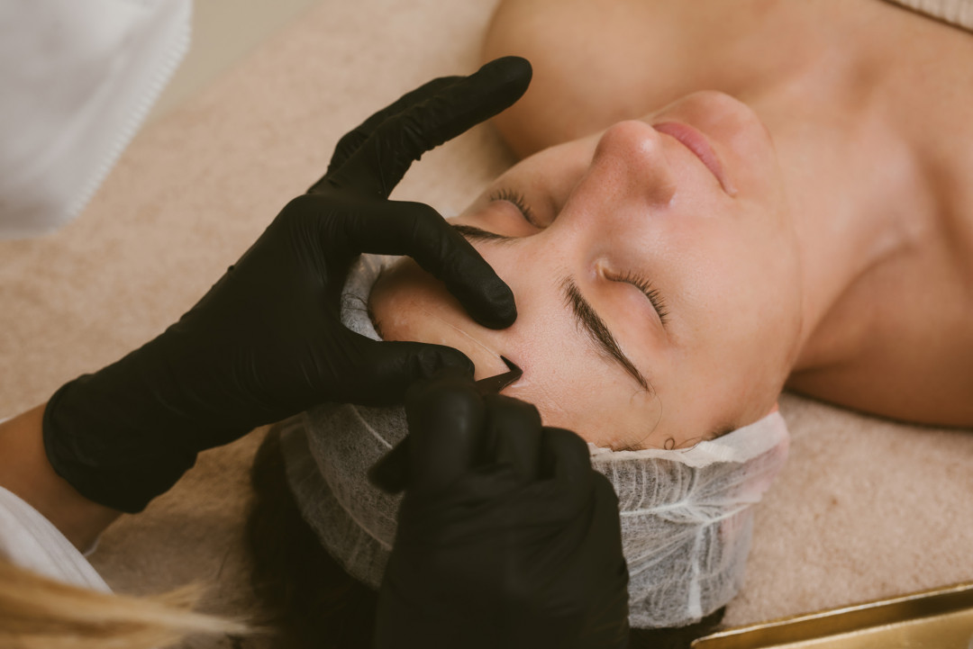 Kolagen niti tretman - bez igle - La Esthetique, Sarajevo Mezoterapija lica Lice Mezoterapija lica, Sarajevo, Novo Sarajevo - Novi Grad