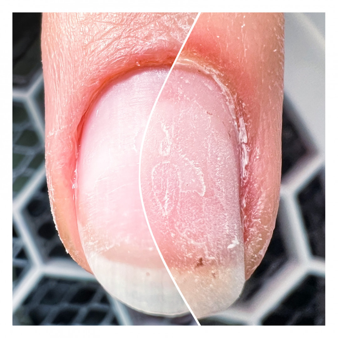 Image #sarajevo Manikir Ruska / kombinovana manikura (Sarah)