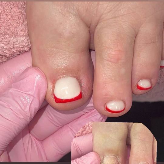 Poezija ljepote #sarajevo Estetski pedikir Ruska pedikura + lakiranje noktiju