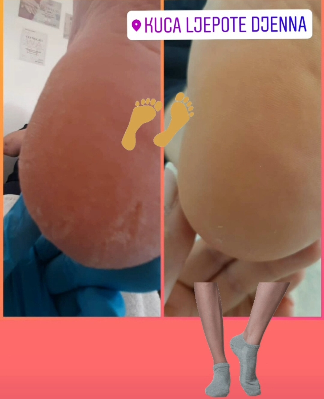 Kuća ljepote Djenna #sarajevo Estetski pedikir Callux pedikir