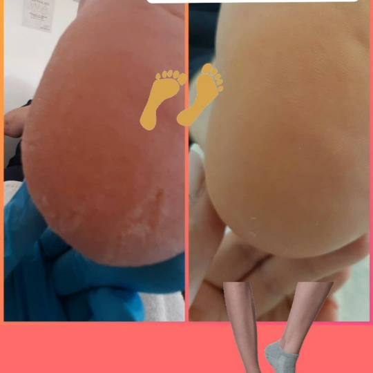 Kuća ljepote Djenna #sarajevo Estetski pedikir Callux pedikir