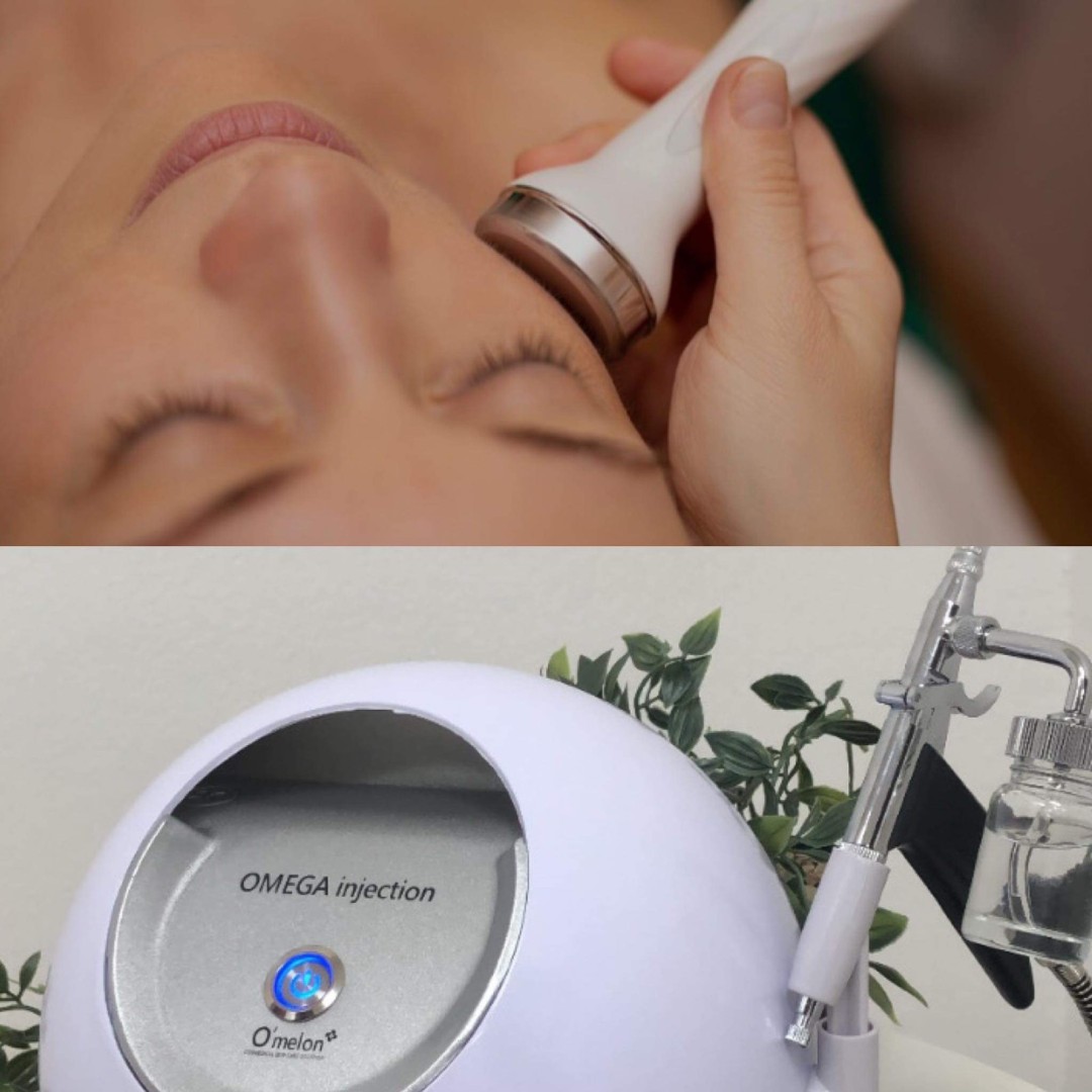 Krasyva #sarajevo Tretman lica Radiotalasni lifting lica